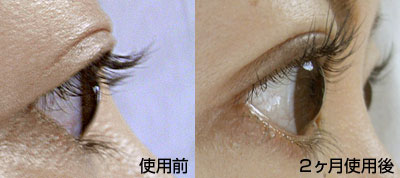効果