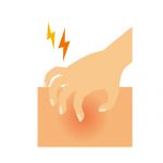 脱毛後に起きる赤みの原因って何？脱毛後の肌の赤みにはどうしたらいいの？